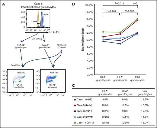 Figure 6. The telomere length of HLA−and HLA+ granulocytes. (A) A representative result of flow-FISH for case 8 is shown. (B-C) The RTLs of HLA− granulocytes, HLA+ granulocytes, and total granulocytes are shown.
