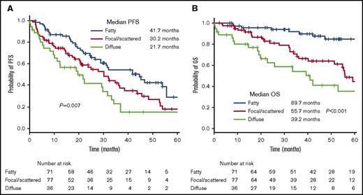Figure 2. Kaplan-Meier curves. (A) PFS and (B) OS according to the medullary pattern of the AS.