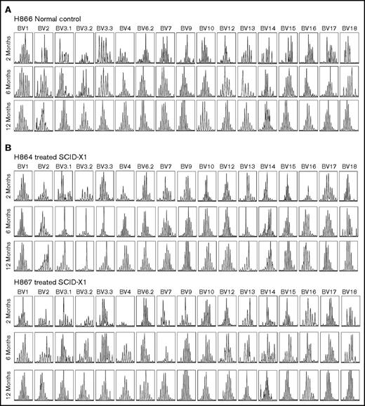 Figure 5. TCR diversity as determined by TCR vector β spectratyping in mobilized FV vector–treated dogs. Rearrangement of the TCR β chain was assessed by PCR amplification of complementary DNA using 17 different primer pairs (annotated on top) at various time points posttreatment in a normal littermate control H866 (A) and in treated SCID-X1 dogs H864 and H867 (B).