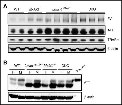 Figure 3. Intracellular FV and AAT levels in WT, Lman1gt1/gt1, Mcfd2−/−, and DKO mice. (A) Comparison of liver FV and AAT levels. Equal amounts of cell lysates (20 µg) from male mouse liver of the indicated genotypes were immunoblotted for FV, AAT, and TRAPα, an ER-resident protein. (B) Comparison of liver AAT levels in male and female mice. Equal amounts of cell lysates (20 µg) from mouse liver of the indicated genotypes and genders were immunoblotted for AAT and β-actin. A WT plasma sample was loaded in the last lane as a positive control.