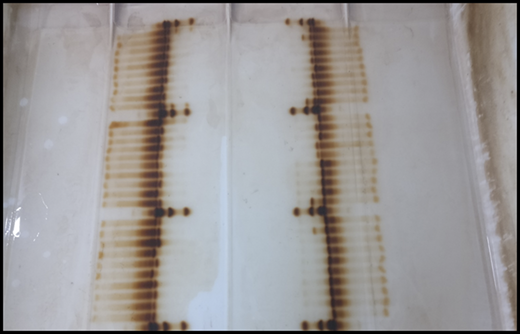 Isoelectric focusing gel.