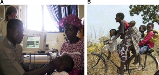 (A) TCD training by Fenella Kirkham, MD. (B) Healthy African children on their way to the clinic.