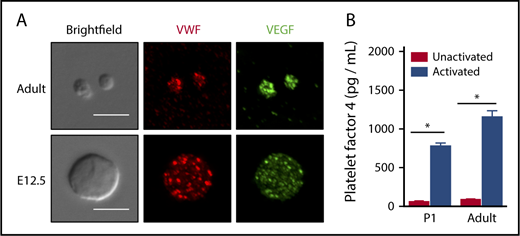 Figure 2. Fetal/neonatal platelets contain a-granules and secrete PF4 on stimulation. (A) Immunofluorescence microscopy of VWF and VEGF protein reveals punctate patterns of expression in resting adult and fetal (E15.5) platelets. Deconvolved merged maximum intensity projection images are shown. Scale bar, 5 μm. Similar patterns were observed in 3 independent experiments. (B) Significant amounts of Pf4 were released after activation of P1 and adult platelets. Platelet activation with thrombin (0.5 U/mL) increases the concentration of Pf4 similarly in supernatants from P1 and adult platelets when evaluated by enzyme-linked immunosorbent assay. Significance was determined using a 2-way ANOVA followed by a Bonferroni posttest, *P < .05 between unactivated and activated samples per age group. Mean ± standard error of the mean shown; n = 4.