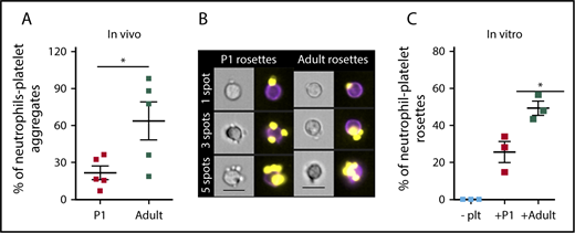 Figure 3. Neonatal platelets do not readily associate with granulocytes in vivo or in vitro. (A) Significantly fewer endogenous neutrophil-platelet aggregates are found in the circulation of neonates compared with adults. n = 5. Significance determined using unpaired Student t test P < .05. Leukocytes were defined as CD45+, granulocytes were defined as CD45+/GR-1+ double-positive, and platelets were CD41+. (B) Representative images of neutrophil-platelet rosettes with 1, 3, and 5 platelet spots. CD41 PE is shown in yellow, and GR-1 fluorescein isothiocyanate is shown in purple. Images were collected at 40× magnification. Scale bar, 10 μm. (C) Fewer rosettes were formed when neutrophils were mixed with activated platelets from P1 pups (+P1) when compared with rosette formation with activated platelets from adults (+Adult). Platelets were activated with 0.5 units/mL thrombin before mixing in a 10:1 ratio with bone marrow-enriched neutrophils. Rosettes were defined as a single neutrophil with 2 or more platelets attached. Significance was determined using an unpaired 2-tailed Student t test *P < .05; n = 3.
