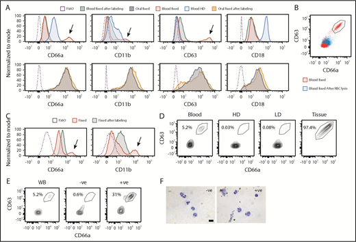 Figure 3. pPMNs are sensitive to conventional methods of purification. (A) Human blood and oral PMNs were fixed prior to, or after, processing and labeling for flow cytometry. Density gradient centrifugation was performed and high-density (HD) PMNs were recovered and labeled for flow cytometry. Histogram plots for representative CD markers on gated PMNs are shown. Arrows indicate the pPMN population. FMO controls are shown. (B) Human blood was fixed prior to, or after, RBC lysis. A representative contour plot of CD66a × CD63 expression on gated PMNs is shown. The pPMN gate is indicated. (C) Mouse blood was fixed prior to, or after, processing and labeling for flow cytometry. Representative histograms are shown. Arrows indicate pPMN populations. FMO controls are shown. (D) Human blood was separated by density centrifugation. CD66a × CD63 scatterplots of gated PMNs are shown from a representative experiment. Representative scatterplots of whole blood PMNs, HD PMNs, low-density (LD) PMNs, and tissue PMNs (oral) PMNs are shown. (E) PMNs were enriched from whole human blood by EasySep magnetic bead negative selection. Representative contour plots are shown for whole blood (WB), bead-negative, and bead-positive populations. (F) DiffQuick images of bead-negative and bead-positive fractions indicate the presence of PMNs in both fractions. Scale bar, 10 µm.