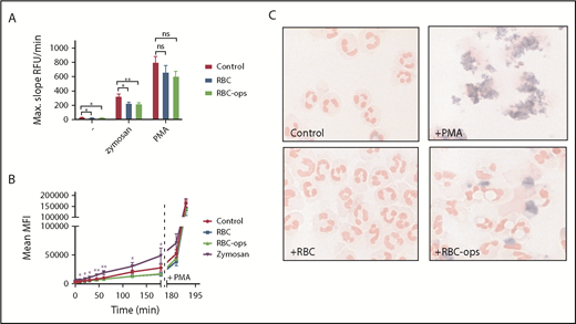 Figure 4. Phagocytosis of RBCs by neutrophils induces a strongly diminished respiratory burst. (A) Release of H2O2 was measured by Amplex Red assay for neutrophils incubated ± RBC or RBC-ops. No burst was measured in the 3 conditions (mean ± SEM; n = 10-12). To control for the ability to produce a respiratory burst, neutrophils from all 3 conditions were stimulated with zymosan or PMA (mean ± SEM; n = 10-12). (B) Release of intracellular H2O2 production was measured using a DHR assay with neutrophils incubated ± RBC or RBC-ops. Neutrophils incubated with zymosan served as a positive control. Addition of PMA at 180 minutes showed neutrophils in all conditions were capable of producing ROS (mean ± SEM; n = 4-13). Asterisks above data points represent significant differences for zymosan compared with control (**P < .01; *P < .05). (C) Respiratory burst was visualized using NBT, which produces a blue precipitate in presence of intracellular ROS. Neutrophils were incubated plus RBC or RBC-ops. Neutrophils plus PMA served as a positive control and neutrophils alone served as a negative control. Images are representative for 3 individual experiments. May-Grünwald Giemsa stain; original magnification ×500. RFU, relative fluorescence unit.