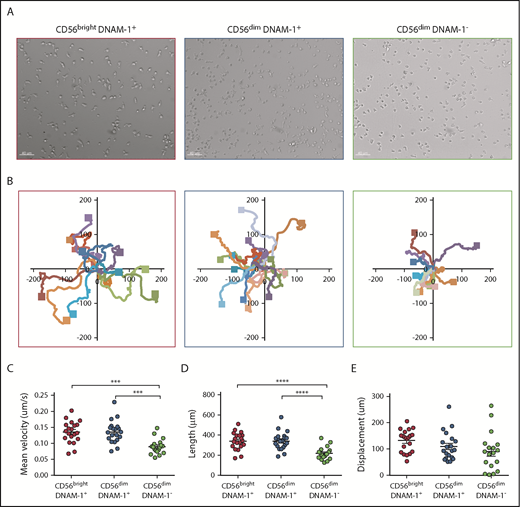Figure 2. DNAM-1pos NK cell subsets display more dynamic and deliberate migration behavior than CD56dim DNAM-1neg NK cells. CD56brightDNAM-1pos, CD56dimDNAM-1pos, and CD56dimDNAM-1neg NK cell subsets were fluorescence-activated cell sorter purified from healthy donor PBMCs. Cells were stimulated overnight with IL-12 (10 ng/mL), IL-15 (100 ng/mL), and IL-18 (50 ng/mL). Time-lapse microscopy was performed by using an Olympus Xcellence IX81 microscope controlled by Xcellence RT software. Images were taken every 40 seconds for 40 to 90 minutes. Images were collected by using a 20× LUCPlanFLN lens with 0.45 NA and Olympus F-View II camera. (A) Representative images. (B) Single-cell tracking map of NK cell trajectories. Mean velocity (C), length of tracks (D), and displacement from origin (E) of individual NK cells were calculated. Each data point represents 1 single randomly selected NK cell tracked over 40 minutes. Results are displayed as the mean ± SEM of at least 6 representative time-lapse videos obtained from 3 independent experiments. Data were analyzed by using a 1-way ANOVA followed by a Tukey multiple comparisons post hoc test. ***P < .001; ****P < .0001.