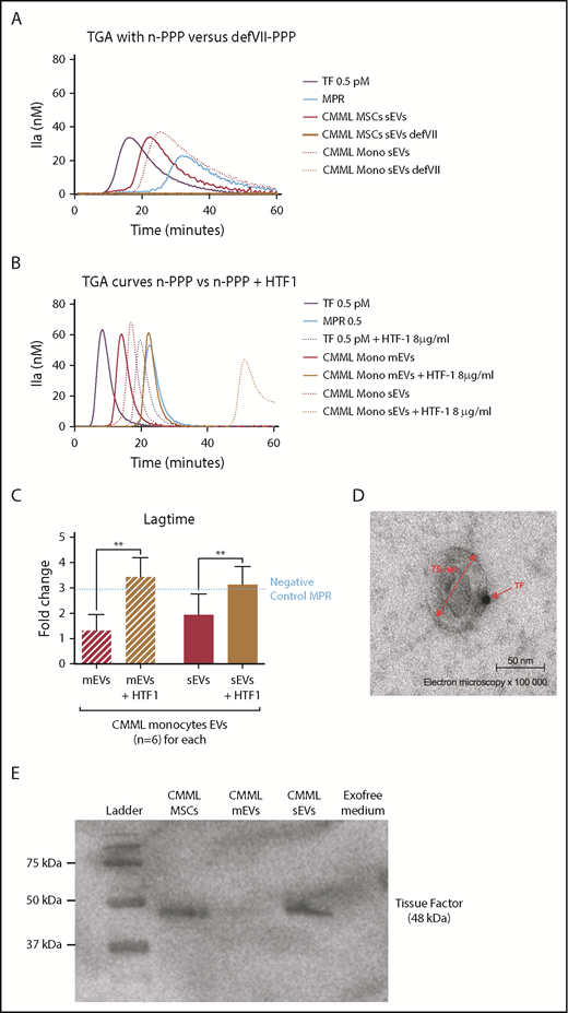 Figure 4. The CMML MSCs and monocyte sEVs procoagulant effect is probably mediated by TF on EV membrane. Lag times are expressed as fold changes of the lag time obtained with the positive control (TF 0.5 pM). The negative control used was MPR 0.5. Any thrombin generated after corresponded to contact-phase activation. **P ≤ .005. (A) TGA curves of CMML MSCs and monocyte sEVs with n-PPP and FVII-deficient plasma (defVII-PPP). TGA conditions performed with normal plasma are represented in red, deficient FVII plasma in mustard, TF 0.5 pM in purple, and MPR in blue. Continuous curves represent MSC sEVs, and dotted curves represent monocyte sEVs. (B) TGA curves of CMML MSCs and monocyte sEVs with n-PPP and n-PPP with a blocking anti-TF antibody (HTF-1) at the concentration of 8 µg/mL. TGA conditions performed without HTF-1 are represented in red and with HTF-1 in mustard. TF 0.5 pM is represented in purple and MPR in blue. Continuous curves represent mEVs, and dotted curves represent sEVs. (C) Effect of a blocking anti-TF antibody (HTF-1, final concentration of 8 µg/mL) on coagulation lag time with n-PPP. TGA conditions performed without HTF-1 are represented in red and with HTF-1 in mustard. TF 0.5 pM is represented in purple. (D) Direct visualization of TF on sEV membranes with electron microscopy. Primary antibody, rabbit anti-TF; secondary antibody, gold-labeled anti-protein A rabbit. Observations were made using a transmission electron microscope (JEOL1200 EX) with a digital camera (VELETA), G = 100 000, at room temperature. (E) Western blot analysis of CMML MSCs and sEVs showing TF expression (48 kDa). CMML MSCs were used as positive control and Exofree medium as negative control.