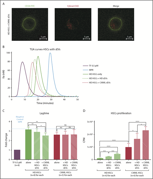 Figure 6. MSC sEVs can interact with HSCs and increase their PCA. Lag times are expressed as fold changes of the lag time obtained with the positive control (TF 0.5 pM). The negative control used was MPR 0.5. Any thrombin generated after corresponds to contact-phase activation. *P ≤ .05, **P ≤ .005, ***P ≤ .0005, ****P ≤ .0001. (A) Visualization of CMML MSC sEV incorporation into HD HSCs by confocal microscopy. HSCs were CD34-FITC labeled, and sEVs were Vybrant DiD labeled; visualization was on a Zeiss Dynascope LSM710 NLO, 63×/1.4 oil-immersion objective, at room temperature. (B) TGA curves of HD HSCs coincubated without or with HD MSCs vs CMML MSC sEVs. HD HSCs alone are represented by a green continuous curve, HD HSCs with HD sEVs by a green dotted curve, and HD HSCs with CMML sEVs by a red dotted curve. TF 0.5 pM is represented in purple and MPR in blue. (C) Effect of sEVs on HSC coagulation lag time. (D) Effect of sEVs on HSC proliferation (by thymidine incorporation). CPM, counts per minute.