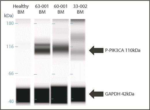 Figure 7. Western blot validation of CBM-predicted protein network activation. Upregulation of the 110-kDa PIK3CA protein in BM samples of 3 patients compared with normal BM from a healthy control subject.