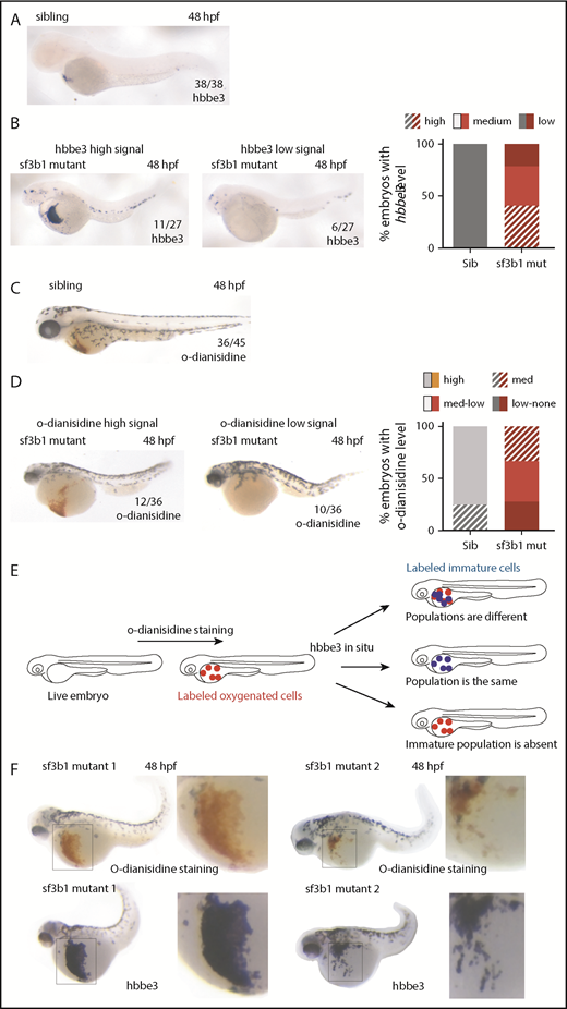 Figure 1. Sf3b1 regulates erythrocyte number and maturation. (A-D) In situ hybridization of early globin hbbe3 (A-B) and o-dianisidine staining (C-D) in siblings (Sib) (A,C) and sf3b1 mutant (mut) (B,D) at 48 hpf. For mutants, example of a high signal embryo is shown on the left and an example of a mutant with low signal is shown on the right. Numbers in the lower right denote number of embryos that displayed a similar phenotype to the image. Graphs on the right denote the percentage of embryos with the designated phenotype. (E) Schematic representing the experimental flow to measure hbbe3 levels in o-dianisidine–positive erythrocytes by sequential staining. O-dianisidine staining was performed first followed by hbbe3 in situ hybridization in the same embryo, thus consecutively labeling oxygenated and immature erythrocytes. (F) O-dianisidine staining (top) followed by in situ hybridization of hbbe3 (bottom) in the same sf3b1-mutant embryos at 48 hpf (2 examples shown). Inset to the right shows a higher magnification view of area boxed in the image on the left. (A-D,F) In situ stain nitroblue tetrazolium, o-dianisidine stain; original magnification ×6, inset ×12. Med, medium.