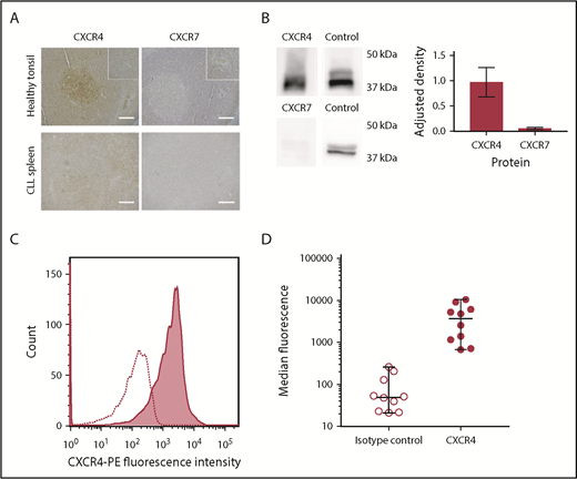 Figure 2. CLL cells consistently express CXCR4 in the peripheral blood and lymphoid organs, whereas CXCR7 expression is significantly lower, (A) Healthy tonsil and CLL spleen sections were stained with antibodies against CXCR4 or CXCR7. In normal tonsil, CXCR4 is widely expressed but with noticeably stronger expression in follicles. In contrast, expression of CXCR7 is weak, and it is expressed primarily by vascular endothelial cells. In organs infiltrated by CLL (shown in spleen), expression of CXCR4 and CXCR7 is observed across the entire sample. CXCR4 staining in proliferation zones is weaker than in other regions of the sample but is still observed. CXCR7 expression is detected, but it is far weaker than CXCR4, with no strong differences observed between proliferation centers and the surrounding tissue. The insets in the upper panels are shown at increased magnification in the lower panels. HRP/DAB technique was used with hematoxylin counterstain. Scale bars, 500 µm. (B) Immunoblot showing relative protein expression levels of CXCR4 and CXCR7 in primary CLL cells, with total ERK1/2 presented as a protein expression control. Densitometric quantification of the blots is shown with adjustment relative to the protein expression control on each blot. Percentage errors were calculated as the average variation between equivalent blots across several experiments. (C) Immunocytofluorescence of CXCR4 assessed by flow cytometry using a phycoerythrin-conjugated CXCR4 antibody for a representative case (shaded graph), with the isotype-control peak shown as a dotted line. (D) Median CXCR4 staining of CLL PBMCs from 10 cases was assessed with flow cytometry using a phycoerythrin-conjugated CXCR4 antibody (●) compared with isotype control (⃝). The median and range of each distribution are represented by horizontal lines. Strong CXCR4 expression is consistently observed, although a significant variation in median staining level was also seen.
