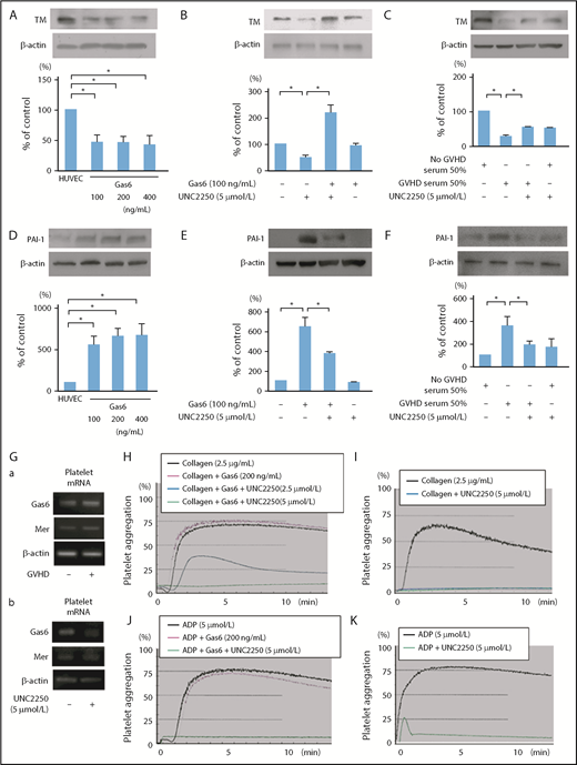 Figure 4. Gas6-Mer axis is involved in the expression of TM and PAI-1 in ECs. (A,D) The downregulation of TM and upregulation of PAI-1 were induced by exogenous Gas6. The ECs were incubated for 24 hours with exogenous Gas6 (0, 100, 200, 400 ng/mL), followed by western blotting. Representative data are from 4 independent experiments. *P < .05. (B,E) The downregulation of TM and upregulation of PAI-1 were increased by exogenous Gas6, and 5 μmol/L UNC2250, a selective Mer tyrosine kinase inhibitor, significantly inhibited the downregulation of TM and the upregulation of PAI-1 in the ECs, which were then incubated for 24 hours with exogenous Gas6 (100 ng/mL) with or without UNC2250 (5 μmol/L), followed by western blotting. Results are shown as mean ± SD of statistical analyses from 4 separate experiments. *P < .05. (C,F) The downregulation of TM and upregulation of PAI-1 were induced by the exposure of sera isolated from patients with grade III aGVHD at 50% (vol/vol) of the total media, and UNC2250 significantly inhibited the downregulation of TM and upregulation of PAI-1 in ECs. The ECs were incubated for 24 hours with the sera isolated from the patients with or without grade III aGVHD at a level of 50% (vol/vol) of the total medium with or without UNC2250 (5 μmol/L), followed by western blotting. Representative immunoblots from 4 similar experiments are shown. Bars are the means ± SD of quantitative densitometric analyses. *P < .05. (Ga-b) mRNA expressed Mer and Gas6 in human platelets of patients with or without aGVHD. To examine whether the platelet mRNA expression of Gas6 and Mer in human platelets is inhibited by UNC2250, real-time PCR was performed. UNC2250 (5 μmol/L) pretreatment (4 hours) decreased the mRNA expression of Gas6 in human platelets of patients without aGVHD, and did not affect the mRNA expression of Mer. Representative data from 3 experiments are shown. (H-K) The effect of UNC2250 on increased platelet aggregation induced by collagen (2.5 μg/mL) and ADP (5 μmol/L) with or without Gas6 (200 ng/mL). Representative data from 3 similar experiments are shown.