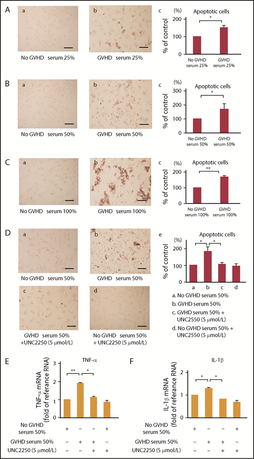 Figure 5. Mer inhibition inhibited endothelial cell apoptosis stimulated by GVHD sera. (A-C) To examine GVHD sera on the apoptosis of ECs, we performed TUNEL staining. ECs were incubated for 24 hours with the sera isolated from patients with or without grade III aGVHD at a level of 0%, 25%, 50%, and 100% (vol/vol) of the total medium, followed by TUNEL staining. Scale bars represent 20 µm. Representative data are from 3 independent experiments. (Ac,Bc,Cc) The statistical analysis indicated the effect of GVHD sera on the EC apoptosis. Results are shown as mean ± SD of statistical analyses from 4 separate experiments. *P < .05; **P < .01. (Da-c) UNC2250 (5 μmol/L) significantly suppressed the EC apoptosis induced by the exposure of sera isolated from patients with grade III aGVHD in ECs at 50% (vol/vol) of the total media. (De) The statistical analysis indicated the effect of exogenous Gas6 or the exposure of sera isolated from patients with grade III aGVHD to ECs on the EC apoptosis. Results are shown as mean ± SD of statistical analyses from 4 separate experiments. *P < .05. (E-F) GVHD sera induced mRNA upregulation of TNF-α and IL-1β, which was inhibited by UNC2250 in ECs. The ECs were incubated for 6 hours with the sera isolated from patients with or without grade III aGVHD at a level of 50% (vol/vol) of the total medium with or without 5 μmol/L UNC2250, followed by real-time PCR. Representative data from 4 similar experiments are shown. Bars are the means ± SD of quantitative densitometric analyses. **P < .01, *P < .05.