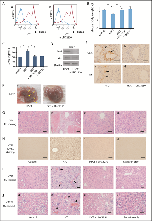Figure 6. Effects of Mer inhibition on GVHD and TA-TMA of liver and kidney in mouse HSCT models Mouse HSCT models intravenously received 3 mg/kg UNC2250 at 14 days after HSCT, and the mouse models were sacrificed on day 21 after HSCT. (A) Mixed chimerism was determined by flow cytometry with anti HLA-antibodies, UNC2250 had no effect on engraftment in the HSCT mice. (B) The body weight of the recipient mice was assessed on the clinical findings using clinical GVHD scores. Body weight loss of the recipient mice was abrogated by intravenous administration of UNC2250. Data are expressed as mean ± SD (n = 9). **P < .01. (C) The levels of serum Gas6 were significantly increased in HSCT mice, using a mouse Gas6 ELISA kit. Data are expressed as mean ± SD (n = 9). *P < .05. (D) UNC2250 downregulated the expression of Gas6 and Mer in the livers of mouse HSCT models, using analysis of liver lysates samples by western blot. Representative data from 3 similar experiments are shown. (Ea-d) The intravenous administration of UNC2250 downregulated the expression of Gas6 and Mer in the mouse HSCT models. Immunohistochemical staining of Gas6 and Mer. Scale bars represent 5 µm. Original magnification ×200. (Fa-b) Macroscopic observations show that a formation of multiple nodules (arrows) was caused by inflammatory response in hepatic GVHD in mouse HSCT models. Intravenous administration of UNC2250 inhibited the characteristic findings of hepatic GVHD in the mouse HSCT models. (G) Hematoxylin and eosin (HE) stain. Scale bars represent 10 µm. Original magnification ×200. Histopathological findings showed that intravenous administration of UNC2250 markedly inhibited histological features of hepatic GVHD showing hepatocellular necrosis, fibrosis, and apoptosis in mouse HSCT models at 21 days after HSCT. (H) TUNEL staining analysis showed that apoptosis of liver cells was substantially reduced in the UNC2250-administered group compared with the non-UNC2250 group. Scale bars represent 5 µm. Original magnification ×200. (I-J) Histopathologic observations showed that formations of thrombi in hepatic and renal vessels were increased in mouse HSCT models at 21 days after HSCT, and intravenous administration of 3 mg/kg UNC2250 significantly suppressed the formations of thrombi in hepatic and renal vessels as compared with the group without treatment. Arrows indicate thrombi formation in vessels of the liver and kidney. Scale bars represent 10 µm. Original magnification ×200.
