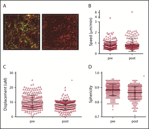 Figure 6. Acute depletion of DCs does not increase CD8 T-cell motility. Irradiated 129 mice were reconstituted with BM from B6 F1(CD11c-YFPxCD11c-DTR) mice, wt B6 CD4 cells and B6 RFP+ CD8 cells. Approximately 28 days after bone marrow transplantation, mice were treated with PBS or with DT 48 and 24 hours before imaging. (A) Still images from representative videos before DT (left panel; supplemental Video 13) or after DT (right panel; supplemental Video 14). CD8+ T-cell mean speeds (B), displacements (C), and sphericity (D) before and after DT treatment. *P < .0001.