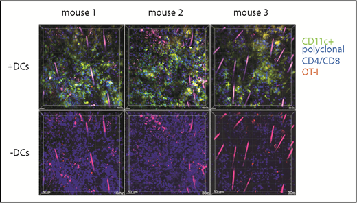 Figure 7. OT-1 effector motility in GVHD skin lesions. One hundred twenty-nine mice were irradiated and transplanted with B6 CD11c-YFP BM and CFP+ B6 CD4 and CD8 cells. On day 28, mice were injected with DsRed+ OT-1 effectors and imaged by 2PIM the following day. Each column shows images from a single mouse. In images in the second row, the YFP channel is masked to better visualize the dsRed+ OT-1 (supplemental Videos 15-20).