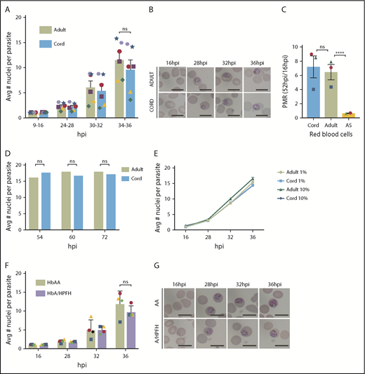 Figure 1. P falciparum growth and proliferation are not inhibited in HbF-containing erythrocytes. (A) Flow cytometry analysis of average number of nuclei per parasite in synchronized, RNase-treated, SYBR Green–stained P falciparum 3D7 IG06 parasites grown in normal adult (AA) and cord blood erythrocytes at 9 to 16, 24 to 28, 30 to 32, and 34 to 36 hpi in 1% O2 demonstrating no significant growth differences using paired analysis in each time point of the cell cycle; N = 6 experiments. (B) Representative Pf3D7 IG06 parasites in thin smears of adult (top) and cord (bottom) blood erythrocytes at 16, 28, 32, and 36 hpi. May-Grünwald-Giemsa stain; scale bars, 10 μm. (C) Parasite multiplication rate (PMR) of Pf3D7 IG06 parasites in cord blood and normal adult blood erythrocytes are similar in 1% O2. PMR in sickle cell trait (AS) RBCs is significantly reduced in low O2; N = 2-3 experiments. (D) Flow cytometry analysis of average number of nuclei per parasite in synchronized, RNase-treated, SYBR Green–stained P falciparum CDPK5 D10 parasites off shield demonstrating equal terminal merozoites in both normal adult and cord blood erythrocytes; N = 2000 infected RBCs counted. (E) Overlap of flow cytometry–based growth curves of average number of nuclei per parasite in synchronized, RNase-treated, SYBR Green–stained Pf3D7 IG06 parasites grown in normal adult (AA) and cord blood erythrocytes at 16, 28, 32, and 36 hpi in 1% and 10% oxygen; N = 3 experiments. (F) Flow cytometry analysis of average number of nuclei per parasite in synchronized, RNase-treated, SYBR Green–stained Pf3D7 IG06 parasites grown in normal adult (AA) and A/HPFH blood erythrocytes at 16, 28, 32, and 36 hpi demonstrating no significant growth difference. (G) Representative Pf3D7 IG06 parasites in thin smears of adult (top) and A/HPFH (bottom) blood erythrocytes at 16, 28, 32, and 36 hpi also demonstrating no difference in morphology. May-Grünwald-Giemsa stain; scale bars, 10 μm. Each colored icon signifies an individual experiment. Error bars are standard error of the mean; ****P = .0001. Avg, average; ns, not significant.