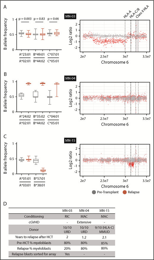 Figure 2. HLA loss at posttransplantation relapse. (A-C) B allele frequency of mismatched SNPs for each matched class 1 HLA gene in pretransplantation (gray) or relapse (red) specimens (left) and copy-number analysis of chromosome 6p (right). (A) The relapse specimen with 20% myeloblast percentage harbors a subtle allelic imbalance of HLA-A (left). Analysis of sorted myeloblasts confirms loss of HLA-A in the relapsed leukemic cells (right). (B) The relapse specimen harbors allelic imbalance of all class 1 HLA genes as a result of copy-neutral loss of heterozygosity across chromosome 6p (right; supplemental Figure 2). (C) The relapse specimen harbors allelic imbalance of HLA-B, which was the result of a 1-Mb deletion spanning HLA-B and HLA-C. (D) Clinical and sample characteristics for cases with relapse-specific HLA loss. cGVHD, chronic graft-versus-host disease; MAC, myeloablative conditioning; RIC, reduced-intensity conditioning; URD, unrelated donor.