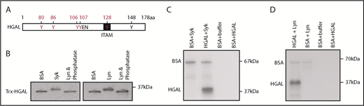Figure 1. Syk and Lyn kinases phosphorylate tyrosine residues in recombinant HGAL protein in vitro. (A) A schematic diagram of HGAL protein showing location of 6 tyrosines, a putative SH2 domain binding motif (YEN), and a first tyrosine (Y128) of modified immunoreceptor tyrosine-based activation motif (ITAM). Microcapillary reverse-phase high-performance liquid chromatography nanoelectrospray tandem mass spectrometry demonstrated that recombinant HGAL protein is phosphorylated on Y80, Y86, Y106Y107, and Y128 (in red) by Syk and Lyn kinase in vitro. Y148 (in black) was already phosphorylated before the addition of kinases. (B) Western blot of HGAL protein following incubation of Trx-HGAL recombinant protein with recombinant Lyn, Syk, or bovine serum albumin (BSA) in a kinase assay. Upward shift of the band in the presence of kinases suggests HGAL phosphorylation, eliminated by the addition of γ-phosphatase. (C-D) Recombinant Trx-HGAL was incubated with Syk kinase or Lyn kinase or bovine serum albumin in a kinase assay cocktail containing 32P-adenosine triphosphate. Samples were loaded on 10% sodium dodecyl sulfate-polyacrylamide gel electrophoresis (SDS-PAGE) gel, dried, and exposed to radiographic film. Data in panels B-D are representative of 3 independent experiments. kDa, kilodaltons.