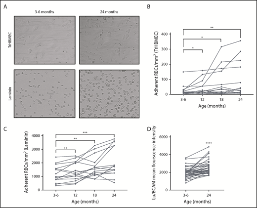Figure 2. Lu/BCAM expression and mediated RBC adhesion. (A) Microscopic images of RBCs adhering to TrHBMEC monolayers and laminin 521-coated microchannels at 3 to 6 and 24 months. Original magnification ×20. (B-C) The amount of adherent RBCs/mm2 on TrHBMEC-coated channels (n = 15) (B) and laminin-coated channels (n = 15) (C) at 3 to 6, 12, 18, and 24 months. *P < .05, **P < .005, ***P < .001, Wilcoxon test. (D) Mean fluorescence intensity of Lu/BCAM on mature RBCs. ****P < .0001, Wilcoxon test.