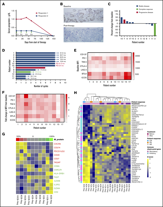 Clinical outcomes and correlative analyses in patients with smoldering myeloma treated with pembrolizumab. (A) Paraprotein 1 and 2 levels in the serum in the extraordinary responder (patient 3) at baseline and after start of pembrolizumab therapy. Arrows indicate day 1 of start of cycles 1, 2, 3, and 4 (C1, C2, C3, C4). Treatment was stopped after C3 due to transaminitis. (B) Immunohistochemistry for plasma cells was performed on bone marrow samples at baseline and after therapy with pembrolizumab using CD138 stain. Baseline sample showed 50% infiltration of plasma cells, and posttherapy sample showed 1% to 2% plasma cells, all of which were of normal phenotype by flow cytometry (data not shown). Original magnification ×5. (C) Best response during treatment period as determined by percent change in serum paraprotein or light chain (in light chain only patients) levels from baseline in all 13 patients. (D) Duration of response and/or clinical benefit in all 13 patients calculated from day 1 of last cycle of pembrolizumab. Number of months of ongoing response, SD, or progressive disease is shown for each patient. (E) Mean fluorescence intensity (MFI) values for expression of various immune stimulatory (CD137 and ICOS) and inhibitory (PD-1, TIM-3, CTLA-4, LAG-3, and BTLA) receptors on CD8+ effectors T cells in bone marrow samples available at baseline from 12 patients are shown as a heat map. (F) Fold change in MFI for the receptors on CD8+ effectors T cells in bone marrow samples from baseline to end of treatment period is shown as a heat map (N = 12 patients). (G) Correlation between IFN-γ gene signature in the CD138− cells in the bone marrow samples at baseline and percent change in paraprotein level (or light chain in light chain–only patients) in serum with therapy. (H) Heat map showing GEP of a curated list of immune stimulatory and immune checkpoint genes in CD138− (Neg) cells from bone marrow samples obtained from patients before (B) and/or after (A) treatment with pembrolizumab.