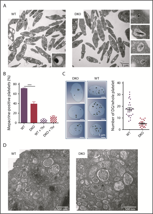 Figure 4. Decreased number and abnormal DGs in Rab32/Rab38 DKO mouse platelets. (A) TEM images showing the ultrastructure of WT and DKO platelets. Right, the close-up views illustrate the various abnormal DG morphologies in DKO mice. Images are representative of at least 3 independent platelet preparations. Scale bar, 1 µm. (B) Evaluation of mepacrine uptake by WT and DKO platelets. Bar graph represents the percentage of mepacrine-positive resting or degranulated platelets (prestimulation with 1 U/mL thrombin) following incubation with 10 µM mepacrine for 30 minutes (n = 3 independent experiments). ***P < .001 using 1-way ANOVA. (C) FIB/scanning electron microscopy images and 3D reconstructions of whole platelets. (Right panel) Dark spots represent DGs reconstructed by drawing the granule membranes on each slice. Note the heterogeneity of the size of the DGs in both genotypes. (Left panel) Quantification of the number of DGs per platelet using 3D FIB/scanning electron microscopy reconstructions (n = 25). (D) TEM images showing the presence of normal MVBs in DKO mouse MKs differentiated in culture from Lin− cells compared with WT. Images are representative of at least 20 MKs. Scale bars, 500 nm.
