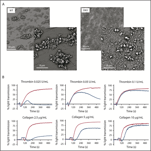 Figure 6. Defective platelet aggregate formation in DKO mice. (A) Whole blood anticoagulated with hirudin was perfused through glass capillaries coated with collagen I fibers for 5 minutes at a shear rate of 1500 seconds−1. Scanning electron microscopy images that are representative of at least 3 independent experiments. (B) Aggregation tracings of WT (red) and DKO (blue) washed platelets stimulated with various concentrations of agonists as indicated. Representative of at least 4 independent experiments.