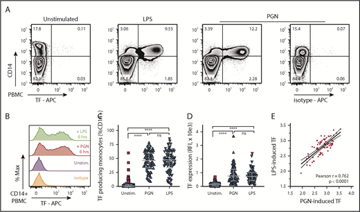 Figure 1. PGN induces TF expression in primary human monocytes in vitro. (A) Exemplification of PBMC procoagulant responses induced by stimulation with either PGN (10 µg/mL) or LPS (1 µg/mL) for 6 hours, as identified by TF expression in CD14+ monocytes in a median responsive individual. (B) Histogram overlay of TF expression in CD14+ PBMCs after PAMP stimulation of a median responsive individual. (C) PAMP induction of procoagulant monocytes (TF+CD14+) in the human cohort studied (n = 86 independent measurements). Horizontal bars depict median and IQR, and outliers are identified by red symbols. (D) Monocyte TF antigen expression (geometric mean of fluorescence intensity) in PAMP-stimulated PBMCs (n = 86). Median, IQR, and outlier representation is consistent with panel C. (E) Correlation between LPS- and PGN-induced procoagulant responses in the study cohort. Individual data represent paired, log-normalized, TF fluorescence intensities of LPS- or PGN-stimulated PBMCs assessed in parallel. Best-fit linear regression (continuous line) and 95% confidence intervals (dotted lines) are graphically represented, and Pearson correlation coefficient (r) is shown in inset. APC, allophycocyanin.