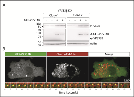 Figure 6. Rescue of VPS33B-KO imMKCLs with GFP-VPS33B shows the VPS33B-VPS16B complex localizes to recycling endosomes. (A) The endogenous VPS16B protein level in 2 VPS33B-KO imMKCL clones transfected with GFP-VPS33B or untransfected control was analyzed by immunoblotting (2 independent replicates per clone). (B) Live cell confocal fluorescence microscopy analysis of VPS33B-KO imMKCL cells cotransfected with GFP-VPS33B and Cherry-Rab11a plasmids. The main panels correspond to the first frame of a movie and display each channel separately and the merge. The region indicated with a dotted rectangle is shown below with frames taken every 5 seconds and highlighting an example of GFP-VPS33B puncta localization to a Cherry-Rab11a compartment over time.