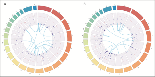 Figure 2. Genomic landscape of somatic mutations, gene fusions, and copy number variations in leukemia. Dark blue dots represent somatic mutation with VAFs. Light blue lines represent fusion genes. Dark bars represent copy number variations. (A) In pretransplant leukemia, WGS and RNA-seq identified 270 somatic mutations (251 mutations in protein-coding genes, 16 in intergenic regions, and 3 in noncoding RNA), 16 fusion genes, and 725 gene loci with copy number variations. (B) Posttransplant leukemia harbors 312 somatic mutations (296 in protein coding genes, 19 in intergenic regions, and 6 in noncoding RNA), 13 fusion genes, and 332 gene loci with copy number variations.
