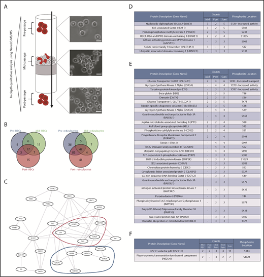 Figure 1. Red blood cell deformation induces measurable changes in the phosphoproteome. (A) Experimental design for proteomic comparison: RBCs and cultured reticulocytes were subjected to flow in a microsphiltration system and lysed before, during, and after passage. The lysates were equalized through hemoglobin quantification using Drabkin’s reagent and analyzed through NanoLC-MS/MS. Cells were fixed and imaged under brightfield at all 3 stages, showing the extent of their deformation within the system and their recovery after passage. Scale bars, 10 μm. (Microsphiltration schematic adapted from Duez et al.48) (B) Venn diagram of differentially phosphorylated proteins with ≥50% detection across all samples in RBCs (left, n = 63 with 33 modifications detected exclusively in cells mid- and postdeformation) and reticulocytes (right, n = 226 with 55 modifications detected exclusively in cells mid- and postdeformation). (C) Top-scoring protein-protein interaction network from the joint dataset of mid- and postdeformation exclusive phosphoproteins in reticulocytes, as predicted by STRING.49 Two main subsets of proteins were present in the network, kinases (marked in red) and vesicle transport-related proteins (marked in dark blue). (D) List of phosphoproteins exclusive to the RBC mid-deformation and mid-/postintersection datasets. Count indicates the number of observed instances of the phosphopeptide (n = 3); the phosphopeptides were sorted by the sum of their counts in both datasets and filtered for their presence in at least 2 samples per condition. PhosphoSite location indicates the predicted location of the phosphorylation site in the protein sequence (as predicted by SEQUEST and/or PhosphoSitePlus data50), as well as the effect of its phosphorylation if described in low-throughput studies according to PhosphoSitePlus.50 (E) List of phosphoproteins exclusive to the reticulocyte mid-deformation and mid-/postintersection datasets (n = 4). Dataset analysis, filtering, and annotation were performed as previously described. (F) List of phosphoproteins present among both reticulocyte and RBC mid-/postdeformation datasets, with no significant detection in the predeformation dataset; dataset analysis, filtering, and annotation were performed as previously described.
