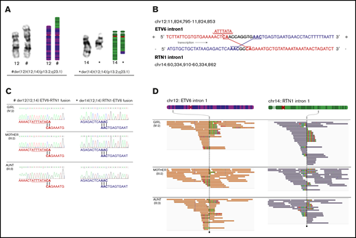 Translocation t(12;14)(p13.2;q23.1). (A) Karyotype images and models of chromosome pairs 12 and 14. The derivate chromosomes, der(12)t(12;14)(p13.2;q23.1)c and der(14)t(12;14)(p13.2;q23.1)c, created by the translocation t(12;14)(p13.2;q23.1), are indicated by # and *. (B) Model of genetic events at breakpoints and fusions. ETV6 and RTN1 are transcribed from the positive strand and negative strand, respectively. ETV6 intron 1 (positive strand) has fused to RTN1 intron 1 (negative strand) creating the chimeric fusion gene ETV6-RTN1 (indicated in red). RTN1 intron 1 (negative strand) has fused to ETV6 intron 1 (positive strand) creating the chimeric fusion gene RTN1-ETV6 (indicated in blue). An 8 bp deletion in ETV6 and a 2 bp deletion in RTN1 have occurred at the breakpoints before fusion. Microhomologies, CA and AAC, were found at the fusion points of each derivate chromosome. A 7 bp insertion was found upstream of the fusion in ETV6 intron 1. (C) Sanger traces of genomic sequence from ETV6-RTN1 and RTN1-ETV6 chimeric fusion genes, supporting identical breakpoints in affected female subjects (III:3 and IV:2) and unaffected carrier (III:2). (D) Germline and remission WGS data from affected female subjects (III:3 and IV:2) and unaffected carrier (III:2) visualized in IGV40,60 showing paired-end reads at translocation breakpoint sites on chromosomes 12 and 14. Coloring of reads (chr12 orange and chr14 purple) indicate that the 2 mates in a read-pair are mapping to different chromosomes, in this case chromosome 12 (ETV6 intron 1) and chromosome 14 (RTN1 intron 1). Multi-coloring of reads indicates mismatched nucleotides. Read-pairs mapping to 2 different chromosomes and mismatched bases on either side of the breakpoint support the presence of translocation breakpoints at either position. Gray arrows indicate the chromosomal regions where breakpoints are found. The genomic positions of breakpoints and sequences at fusion sites are identical in all 3 individuals analyzed.