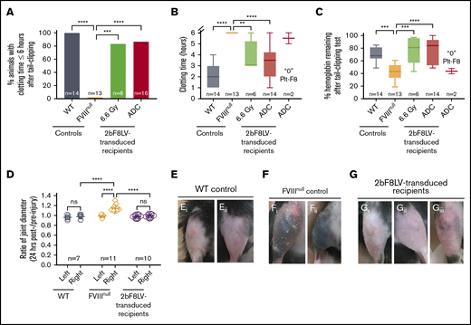 Phenotypic correction assessment of HA mice after platelet-specific gene therapy under ADC-mediated preconditioning. At least 4 months after 2bF8LV gene therapy, the bleeding phenotype in 2bF8LV-transduced recipients was assessed by a 6-hour tail-bleeding test and a needle-induced knee joint injury. For the tail-bleeding test, the tail tip was transected using a 1.6-mm-diameter template. Animals were monitored hourly, and clot time was recorded. Blood samples were collected before and after the test for blood counts. Hemoglobin level before the test was normalized to 100%. For the knee joint injury, a G30 × 1/2 needle was used to induce injury in the right knee, leaving the left knee unharmed as an intra-animal control. The diameter of the knee joint was measured using a digital micro caliper before and 24 hours after injury. The diameter of the knee joint before injury was defined as 1. WT and FVIIInull mice served as controls. (A) Percentage of animals whose tail bleeding stopped within 6 hours after tail tip transection. The statistical differences between the groups were analyzed using Fisher’s exact test. (B) Tail-bleeding time. Data from the 2 2bF8LV-transduced recipients in the (CD45.2+CD117)-ADC group that did not have sustained platelet FVIII expression are presented as a separate group. The statistical differences between the groups were analyzed using 1-way analysis of variance (ANOVA), followed by Tukey’s multiple-comparisons test. (C) Percentage of hemoglobin remaining after the tail-bleeding test. Data from the 2 2bF8LV-transduced recipients in the (CD45.2+CD117)-ADC group that did not have sustained platelet FVIII expression are presented as a separate group. The statistical differences between the groups were analyzed using 1-way ANOVA, followed by Tukey’s multiple-comparisons test. (D) Ratio of knee joint diameter measured at 24 hours postinjury/preinjury. The statistical differences between the groups were analyzed using 2-way ANOVA, followed by Tukey’s multiple-comparisons test. Representative images of the knee joint from WT control mice (E) and FVIIInull control mice (F) 24 hours after injury. (G) Representative images of the knee joint from 2bF8LV-transduced recipients with ADC preconditioning 24 hours after injury. These data demonstrate that effective phenotypic correction is attainable in HA mice after 2bF8 lentiviral gene delivery to HSCs under a nongenotoxic hematopoietic cell–targeted ADC preconditioning. **P < .01, ***P < .001, ****P < .0001. ns, not significant.