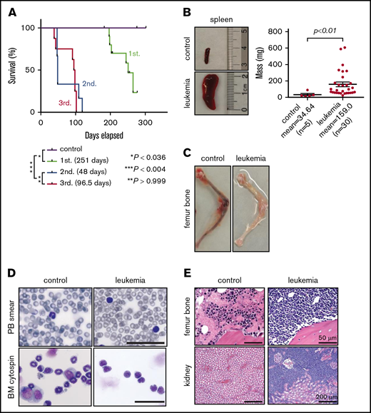 Gene-edited MLLr hUCB cells develop leukemia in xenotransplanted mice. (A) Survival curves for xenotransplanted mice with mean latencies for development of primary (1st.), secondary (2nd.), and tertiary leukemias (3rd.) of 251, 48, and 96.5 days, respectively. Latencies and P values were determined using the log-rank test. Leukemic involvement of spleen (B), leg bones (C), peripheral blood (PB) (D; upper panels), and BM (D; lower panels, Giemsa stain). Scale bars, 100 μm. (E) Hematoxylin and eosin–stained sections of the indicated tissues from control and leukemic mice.