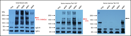 Erythroid-specific expression of ET3. Immunoprecipitation/western blot with lysates from total blood cells (ie, mostly erythrocytes) and erythroid (Ter119+) and nonerythroid (Ter119−) bone marrow fractions. Each lane is an individual mouse. The specific ET3 band appears ∼168 kDa. IgG-H and IgG-L labels bands for light and heavy immunoglobulin chains.