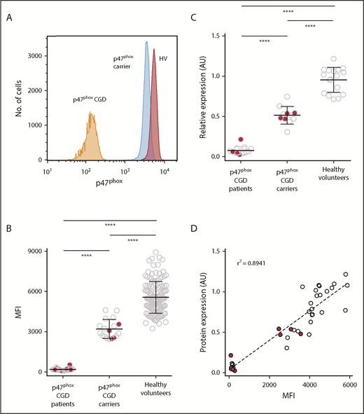 Figure 3. Quantitative analysis of p47phox expression by FACS analysis and immunoblotting. To determine p47phox expression, whole blood was permeabilized/fixed and then stained with anti-p47phox antibody. Neutrophils were gated using forward and right-angle light scatter. The level of p47phox expression on neutrophils is presented as the mean fluorescence intensity (MFI). (A) Relative histograms of a p47phox CGD patient, a p47phox CGD carrier, and a healthy volunteer. Summary data of the different populations are presented as scatter plots (B). Solid red circles in panels B, C, and D represent p47phox patients and carriers with non-ΔGT mutations in NCF1. (C) A subset of patients and carriers of p47phox CGD and healthy volunteers were analyzed for p47phox expression by immunoblotting. The data for of p47phox expression are presented as arbitrary units relative to the expression of β-actin. Neutrophil lysates from at least 2 healthy normal volunteers were analyzed on each gel, and the mean ratio of p47phox:β-actin for the normal samples was set to a value of 1.0. (D) The correlation obtained from parallel studies analyzing the expression of p47phox by both flow cytometry and immunoblotting. ****P < .0001 (1-way analysis of variance using Tukey’s multiple comparison).