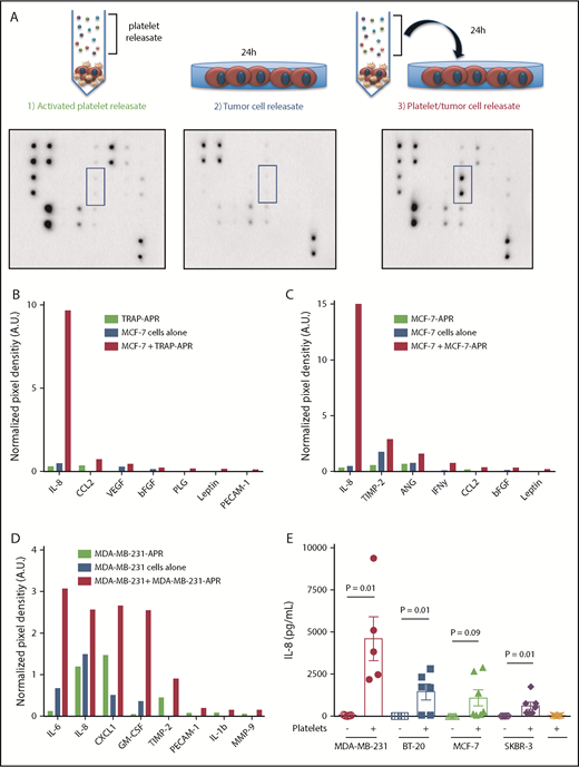 Figure 1. Platelets reprogram the breast tumor cell secretome. Angiogenesis arrays were used to identify factors secreted by breast tumor cells after exposure to APR. (A) To generate APR, platelets were exposed to 25 μM thrombin receptor activator peptide 6 (TRAP) or 3 × 106/mL tumor cells, causing platelet activation and the release of stored factors into the supernatant. Tumor cells were then exposed to APR for 24 hours, and the resulting conditioned media was collected and compared with either APR alone or tumor cell-conditioned media alone. (A) Representative images from arrays are shown. Blue highlighted areas represent interleukin 8 (IL-8) signal. Three separate array experiments were performed: (B) MCF-7 tumor cells exposed to TRAP-induced APR (C) MCF-7 tumor cells exposed to MCF-7-induced APR and (D) MDA-MB-231 tumor cells exposed to MDA-MB-231-induced APR. Arrays were analyzed by densitometry, and factors that were increased at least 1.5-fold in the supernatant of releasate-treated tumor cells are depicted. (E) MDA-MB-231, BT-20, MCF-7, and SKBR-3 breast cancer cell lines were co-incubated with platelets for 24 hours and IL-8 within the supernatant measured by ELISA. For ELISAs, P values were determined by separate unpaired 2-tailed Student t tests. n = 5 to 7 independent replicates per treatment group. Angiogenesis array data represents a single experiment.