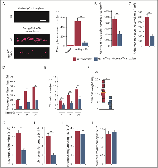 Figure 6. Signaling through gp130-containing receptors on endothelial cells increases P-selectin–dependent thrombosis in flow-restricted veins. (A) Representative images of gp130 expression (red) in the IVC of tamoxifen-treated WT or gp130flox/floxVECad-Cre-ERT2 mice obtained with spinning-disk intravital microscopy. Fluoresbrite red microspheres coated with anti-gp130 mAb or isotype control mAb were injected IV into tamoxifen-treated WT or gp130flox/floxVECad-Cre-ERT2 mice 20 minutes before exposing the IVC. Top, IVC of tamoxifen-treated WT mouse injected with isotype control mAb-coated beads; middle, IVC of tamoxifen-treated WT mouse injected with anti-gp130 mAb-coated beads; bottom, IVC of tamoxifen-treated gp130flox/floxVECad-Cre-ERT2 mouse injected with anti-gp130 mAb-coated beads. The graph at right indicates quantification of the covered area of adherent microspheres with digital image-analysis software. The data represent the mean ± SEM from 5 mice. Scale bar, 10 μm. (B-C) Quantification of endothelial surface area covered with firmly adherent Ly6G+ neutrophils or M-CSFR+ monocytes, 3 hours after ligation of the IVC. (D-E) Kinetics of thrombus development (frequency) and thrombus size (area) in mice of the indicated genotype, measured by ultrasonography at the indicated times after ligation. (F) Thrombus weight in the indicated genotype 24 hours after ligation. Each symbol represents an individual thrombus. Horizontal red bars represent median values. (G-H) Number of Ly6G+ neutrophils or M-CSFR+ monocytes per thrombus 24 hours after ligation in the indicated genotype, as measured by flow cytometry. (I-J) Normalized thrombus weight per Ly6G+ neutrophil or M-CSFR+ monocyte. The data represent the mean ± SEM from 5 to 12 mice in each group. *P < .05; **P < .01.