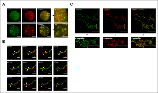 Live cell fluorescence and super-resolution structured illumination microscopy reveal distinct subpopulations of α-granules and VAMPs, in mature mouse MKs. Mouse fetal liver derived MKs were cultured overnight with Alexa 488-fibrinogen (FG488) and Alexa 568-endostatin (ENDO568) or Alexa 488-fibrinogen and Alexa 546-fibrinogen (FG546). (A) Structured illumination microscopy of MKs containing fluorescently tagged ENDO and fibrinogen. The yellow boxes, and their corresponding magnified insets, highlight separation of FG488/ENDO568 in the upper panels and colocalization of FG488/FG546 in the lower panels. Images are maximum intensity projections. For FG488/ENDO568, scale bar is 5 µm for full images, and 2 µm for the inset. For FG488/FG546, scale bar is 10 µm for full images, and 5 µm for inset. (B) Time lapse imaging of a proplatelet containing FG488 and ENDO568. White arrowhead denotes fibrinogen-containing granule; open arrowhead denotes ENDO-containing granule. Images were taken every 5 minutes for 1 hour. Scale bar is 5 µm. (C) Structured illumination microscopy of VAMP-3 (green) and VAMP-8 (red). Note that the proplatelet shown in the insets are circular in structure. Images are maximum intensity projections. Scale bar is 25 µm for full images, and 8 µm for insets. For VAMP-3 and VAMP-8 costaining, the Pearson’s R value is 0.21 ± 0.02. Three proplatelet producing MKs were analyzed.