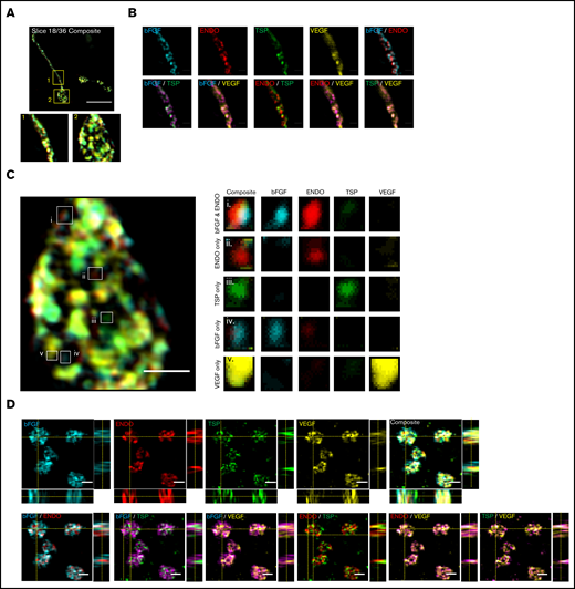 Super-resolution structured illumination and immunogold electron microscopy reveals distinct α-granule subpopulations in mouse proplatelets and human platelets. Mouse fetal liver derived MKs were isolated with a BSA gradient. Released mouse proplatelets were stained with antibodies against bFGF, ENDO, TSP, and VEGF and imaged with structured illumination microscopy. (A) A single slice of a composite stack of a released proplatelet. Scale bar is 10 µm. Magnified images show proplatelet shaft (1) and tip (2). (B) Distribution of α-granule cargo proteins were determined by overlaying different staining combinations. Scale bar is 1 µm. (C) Full image of proplatelet tip (left). White boxes highlight granules of distinct protein cargo, magnified on right. Scale bar is 1 µm. (D) Human platelets were probed with antibodies against bFGF, ENDO, TSP, and VEGF and imaged with structured illumination microscopy. Images are maximum intensity projections. Scale bar is 2 µm. (E) Double immunogold labeling of human platelet sections using anti-ENDO and antifibrinogen primary antibodies followed by staining with protein A–gold conjugated to 10 nm (fibrinogen; red arrows) or 15 nm (ENDO; white arrows). Scale bar is 100 nm.