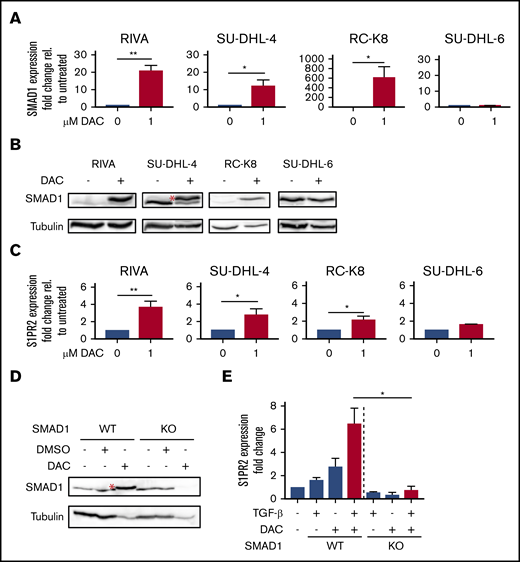 SMAD1 expression is restored by DAC treatment. SMAD1 expression at the transcript (A) and protein (B) levels after DAC treatment (1 μM for 96 hours) of 4 DLBCL cell lines, as determined by qRT-PCR and western blotting. (A) Results from 4 (RIVA, SU-DHL-4, and RC-K8) and 2 (SU-DHL-6) independent experiments are pooled. SU-DHL-6 cells express SMAD1 prior to DAC treatment; all other cell lines are initially (pre-DAC) SMAD1−. (C) S1PR2 expression at the messenger RNA level after 1 μM DAC treatment (1 μM for 96 hours) of the cell lines in panel A. Pooled results from 4 (RIVA, SU-DHL-4 and RC-K8) and 2 (SU-DHL-6) independent experiments are shown. (D) SMAD1 expression of SMAD1WT and SMAD1KO SU-DHL-4 cells after exposure to DAC or vehicle control. The red asterisks (*) in panels B and D mark the correct band corresponding to SMAD1. Note that in SU-DHL-4 cells, and to a lesser extent in RIVA and RC-K8 cells (B), our SMAD1 antibody recognizes a second faster migrating band that is not SMAD1, because it is not lost in SMAD1KO SU-DHL-4 cells, and that goes away upon DAC treatment. (E) Relative S1PR2 expression, as determined by qRT-PCR, of SMAD1WT and SMAD1KO SU-DHL-4 cells after DAC (1 μM for 96 hours) and TGF-β (2 ng/mL for 24 hours) treatment. Pooled results from 3 independent experiments are shown. Bar graphs show mean + SEM. *P < .05, **P < .01, Student t test.