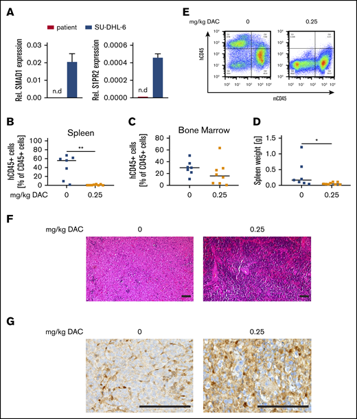 SMAD1−DLBCL patient cells respond to DAC treatment in a patient-derived xenograft model. (A) SMAD1 and S1PR2 expression in CD19+ primary DLBCL cells, as determined by qRT-PCR; SU-DHL-6 cells are shown as positive control. Percentages of human CD45+ cells in the spleen (B) and bone marrow (C) of MISTRG6 mice that were injected with primary DLBCL cells and treated with 0.25 mg/kg DAC for 3 cycles of 5 days per week. (D) Spleen weights at the end point. (E) Representative FACS plots showing frequencies of human and mouse CD45+ cells in the spleens. In panels B-D, each symbol represents 1 mouse and horizontal lines represent median values; data are pooled from 3 independent experiments. (F) Hematoxylin and eosin–stained sections of spleens from representative mice treated or not with DAC. Scale bars, 100 μm. (G) SMAD1 immunohistochemical staining of representative mice treated or not with DAC. Scale bars, 100 μm. *P < .05, **P < .01, Mann-Whitney U test. n.d., not detectable.