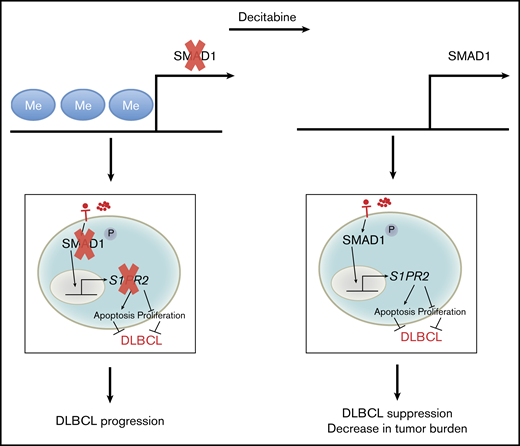 Schematic summary of the dysregulation of SMAD1 expression by promoter hypermethylation and the consequences for DLBCL survival and growth. In both subtypes of DLBCL, the promoter region of SMAD1 is recurrently hypermethylated, which causes SMAD1 gene repression. Repression of SMAD1 blocks the tumor-suppressive TGF-β/SMAD1/S1PR2 pathway. Loss of S1PR2 expression within the germinal center promotes B-cell proliferation and prevents S1P-driven apoptosis. DAC demethylates SMAD1 and restores SMAD1 expression, allowing its phosphorylation upon TGF-β binding and its translocation into the nucleus, followed by S1PR2 expression, as well as a reduction in the tumor burden in experimental settings.