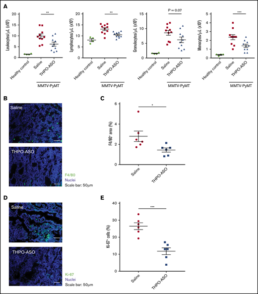 Peripheral leukocyte profile, and intratumoral macrophages and cell proliferation index. (A) Leukocyte profile from complete blood counts at 80 days of age in healthy and MMTV-PyMT mice. (B) Representative images of tumor-infiltrating macrophages on histopathology at the time of euthanasia (complete palpable tumor volume of 2 cm3). Macrophages were visualized with an antibody directed against F4/80, the murine homolog of epidermal growth factor–like module-containing mucin-like hormone receptor-like 1 (green). Nuclei were visualized with Hoechst 33342 (blue). Scale bars, 50 µm. (C) Percentage of F4/80-positive area in the field of view in tumors from untreated (n = 6) and THPO-ASO–treated (n = 6) mice. A 2-tailed, unpaired Student t test was used for comparison of means. *P < .05; **P < .01; ***P < .001. (D) Representative images of proliferating cells in tumors. Proliferating cells were identified by Ki-67, an antibody directed against the MKI67 proliferation-related antigen (green). Nuclei were visualized with Hoechst 33342 (blue). Scale bars, 50 µm. (E) Number of Ki-67–positive (S-phase) cells in magnification field in samples from untreated (n = 6) and THPO-ASO–treated (n = 6) mice. Fifteen fields of view per tumor were analyzed for quantification. Every breast tumor was evaluated for each mouse. A 2-tailed, unpaired Student t test was used for comparison of means. *P < .05.