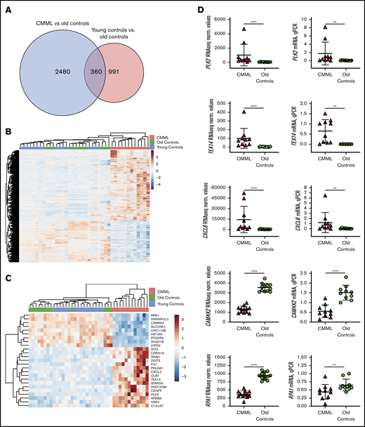 Identification of a CMML transcriptional signature. (A) Venn diagram illustrating the number of differentially expressed genes in CMML vs old controls (blue) compared with young controls vs old controls (red) using an FDR < 0.01. (B) Unsupervised clustering heat map of the 2480 genes that are unique to the CMML vs old controls set, shown in CMML and normal old and young control monocytes. (C) Heat map of the top 25 most significant genes of the CMML signature. (D) RNAseq and qPCR gene expression normalized values for TEX14, PLK2, CAMKK2, RPA1, and CXCL8 transcripts. P values were calculated using the nonparametric Mann-Whitney U test. **P < 0.01; ****P < 0.0001.