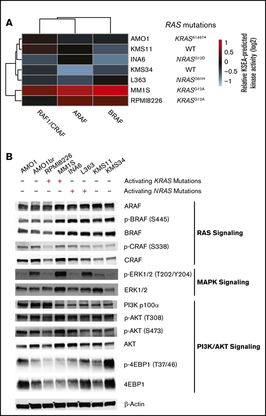 KRAS mutant MM cell lines show greatest activation of downstream RAF effectors based on phosphoproteomics. (A) Heatmap of KSEA-predicted activity of the immediate downstream substrates of Ras protein (ARAF, BRAF, and RAF1/CRAF) across the 7 profiled myeloma cell lines. (B) Western blot analysis of RAS, MAPK, and PI3K/AKT pathway signatures in MM cell lines.
