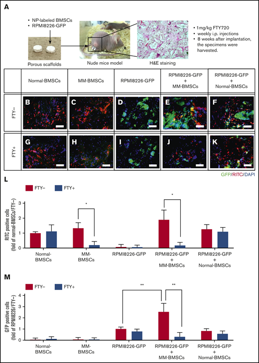 FTY720 indirectly and directly inhibited the proliferation of MM cells in vivo. (A) Schematic of in vivo 3-dimensional coculture model. Scale bars, 1 µm. (B-K) Fluorescence microscopic examination of RITC+ cells (nanoparticle-labeled BMSCs; red) and GFP+ cells (RPMI 8226-GFP; green) 8 weeks after implantation of scaffolds impregnated with normal-BMSCs (B,G), MM-BMSCs (C,H), RPMI 8226–GFP (D,I), RPMI 8226–GFP+ MM-BMSCs (E,J), and RPMI 8226–GFP+ normal-BMSCs (F,K). Nuclear counterstaining was performed by using DAPI (blue). Scale bars, 200 µm. (L) Quantitative data for RITC+ cells in the scaffold determined according to pixel density. *P < .01 (Student t test). Values are mean ± standard deviation. (M) Quantitative data for GFP+ cells in the scaffold determined according to pixel density. **P < .001 (Student t test). Values are mean ± standard deviation. FTY+, mice treated with 1 mg/kg of FTY720; FTY−, mice without FTY720; H&E, hematoxylin and eosin.