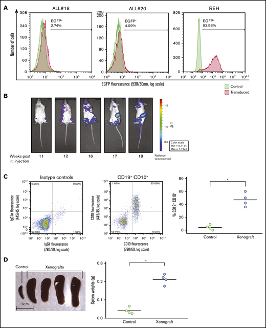 Establishment of xenograft model of ALL in NSG mice. (A) Lentiviral transduction efficiency of the pSLIEW vector into ALL#18, ALL#20, and REH cells was measured by flow cytometry analyses of EGFP fluorescence. (B-D) Four mice were IT injected with transduced ALL#18. (B) Progression of xenograft ALL#18 was followed by detection of luminescence intensity using noninvasive in vivo imaging, starting at 11 weeks after IT injection. (C) End point flow cytometry analysis of CD19+CD10+ leukemic cells in the bone marrow of xenograft ALL#18 mice. (Left) Dot plot presentation of CD19 vs CD10 expression of bone marrow cells from the mouse shown in panel B. (Right) The percentage of human CD19+CD10+ leukemic cells within the total bone marrow cell population of xenograft ALL#18 mice compared with noninjected (control) mice. Each circle represents the percentage of CD19+CD10+ cells in the bone marrow of 1 mouse. Horizontal lines represent the mean of each treatment group, *P < .01 (unpaired Student t test). (D, left) Spleens from 4 xenograft ALL#18 mice and from 1 noninjected (control) mouse. (Right) Weight of spleens from the 4 xenograft mice compared with spleens from 4 control mice. Each circle represents the spleen weight (g) of 1 mouse. Horizontal lines represent the mean of each treatment group, *P < .01 (unpaired Student t test).