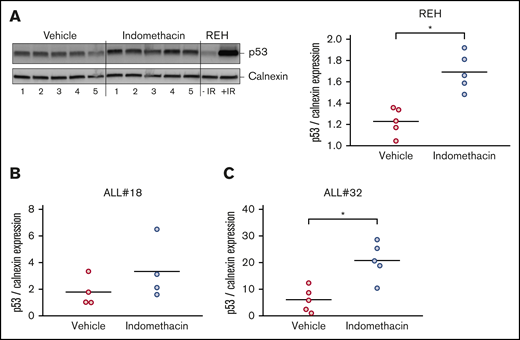Indomethacin enhances p53 levels in bone marrow cells from xenograft mice. Bone marrow cells were harvested from xenograft REH mice, xenograft ALL#18 mice, or xenograft ALL#32 mice treated with indomethacin or vehicle for 4, 16, or 23 weeks, respectively. Cells were subjected to western immunoblot analysis with antibodies specific for human p53 as described in “Materials and methods." Calnexin was used as loading control. (A, left) Western immunoblot of p53 and calnexin expression from xenograft REH mice. Regular REH cells treated with and without irradiation (IR) were used as controls for human p53. (Right) Quantification from the immunoblot in the left panel of p53 band intensities relative to calnexin. Quantifications from immunoblots of p53 band intensities relative to calnexin from xenograft ALL#18 (B) and ALL#32 (C) mice. (A-C) Each circle represents the intensity of p53 relative to calnexin in 1 mouse. Horizontal lines represent the mean of each treatment group, *P < .01 (unpaired Student t test).